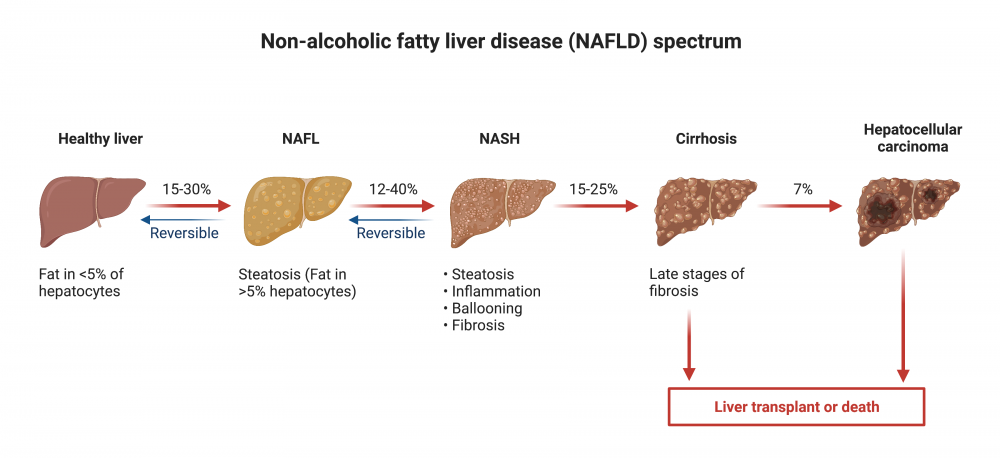 Non-Alcoholic Fatty Liver Disease (NAFLD) Spectrum - Alinea Nutrition