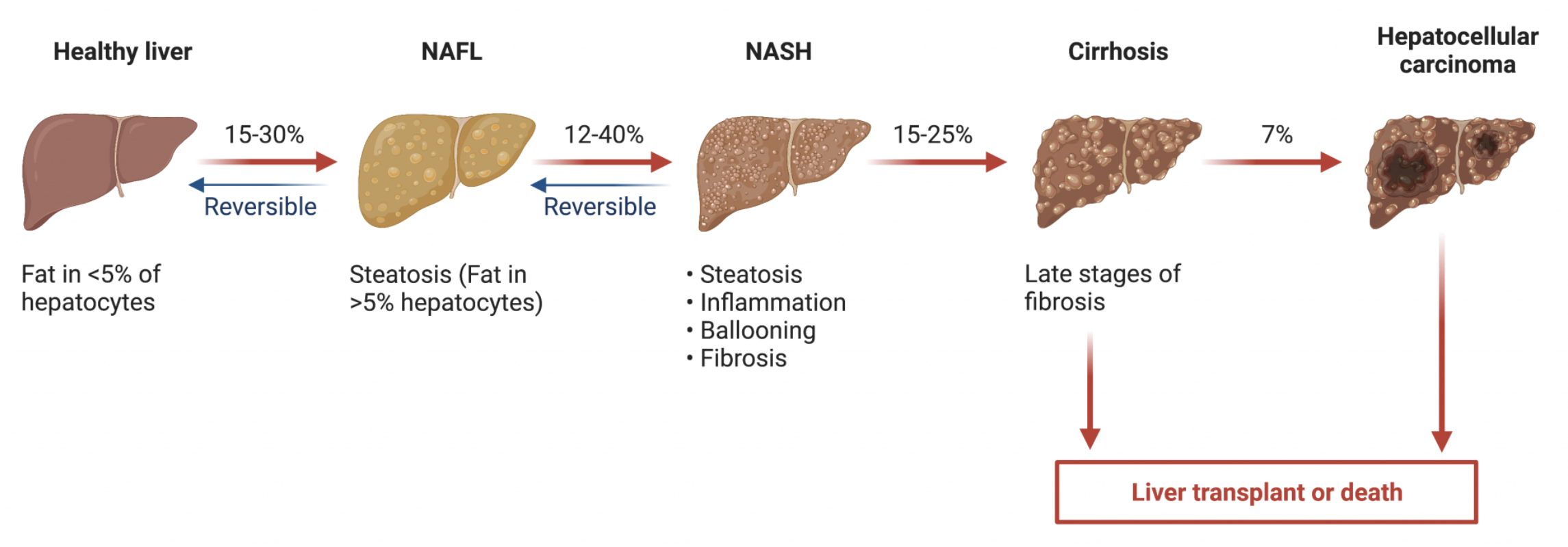 Chart shoring the various states of the liver from healthy to severely damaged.
